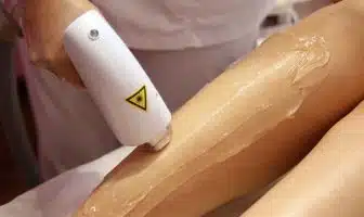 a woman getting a laser on her leg