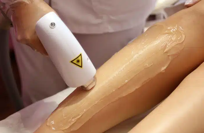 a woman getting a laser on her leg