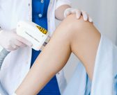 Faites le choix d’une épilation laser efficace à lille